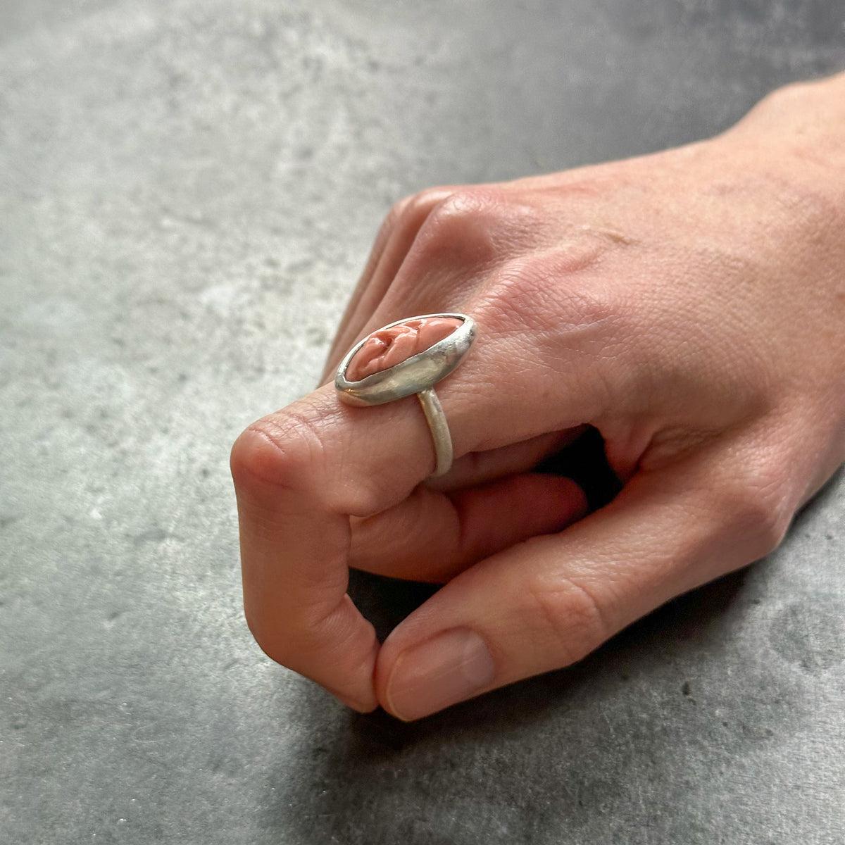 Vulva Ring