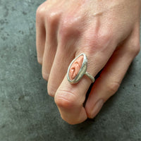 Vulva Ring