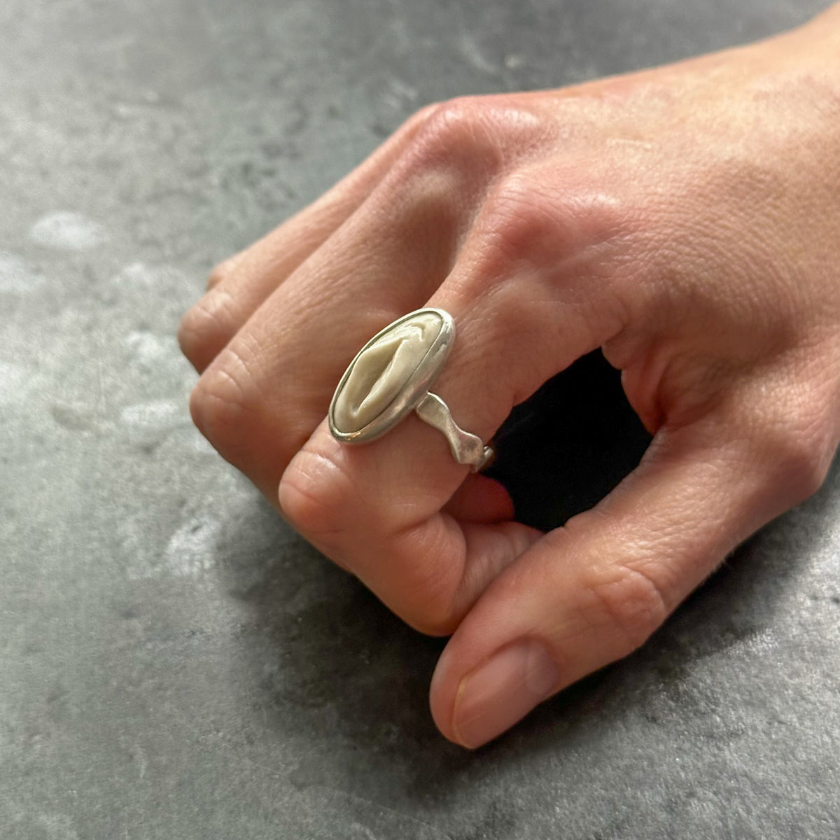 Vulva Ring