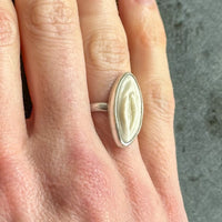 Vulva Ring