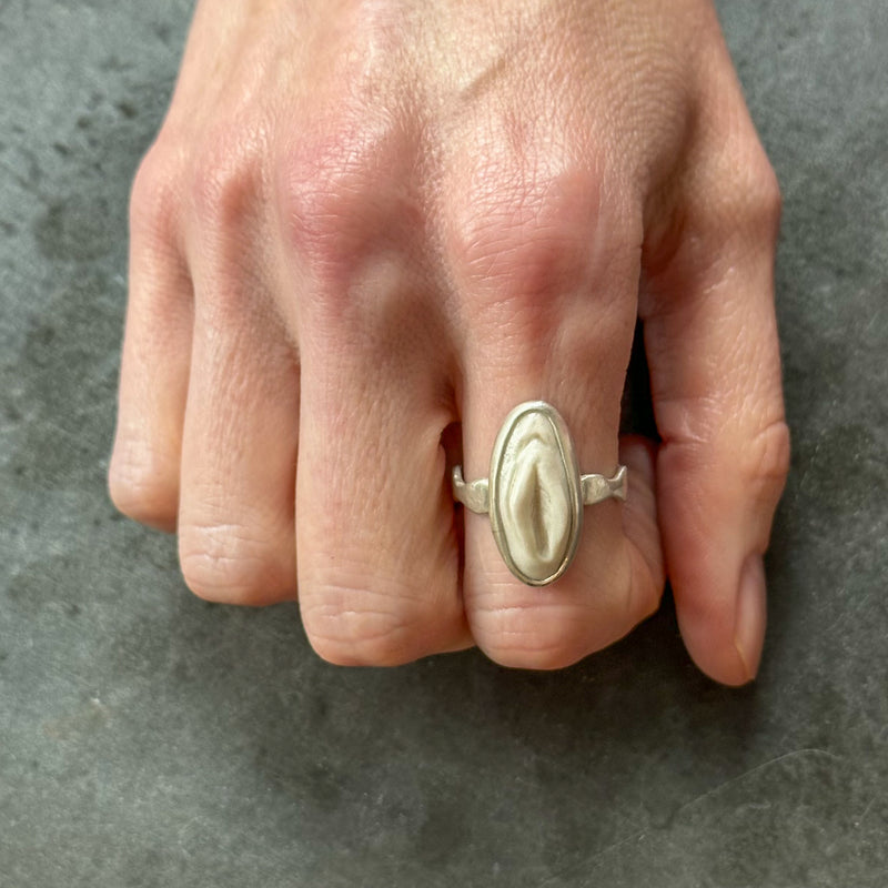 Vulva Ring